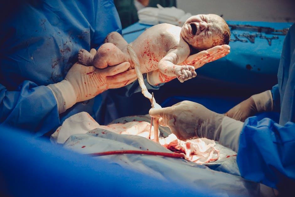 Image of a newborn baby en caul, still encased in the translucent birth sac, representing the miracle of life and the special bond between parent and child.